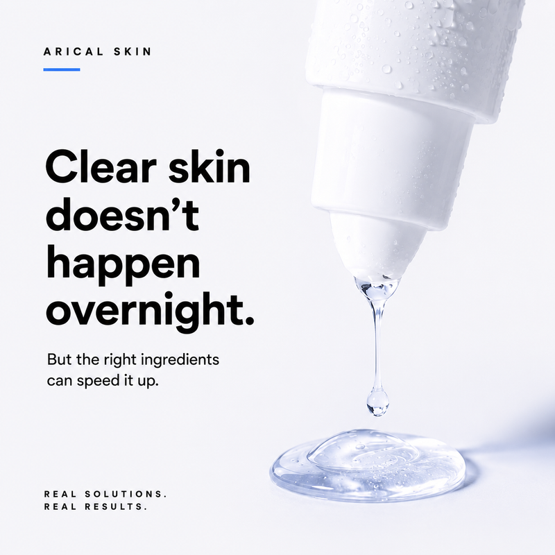 Acne Prone Skin